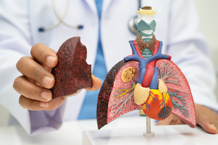 Pneumonia, lung cancer, Asian doctor holding human anatomy model for study diagnosis and treatment in hospital.の写真素材