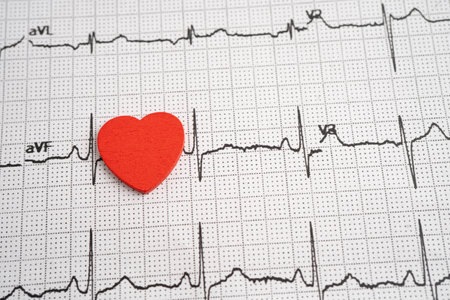 Electrocardiogram ECG heart wave, heart attack, cardiogram report.