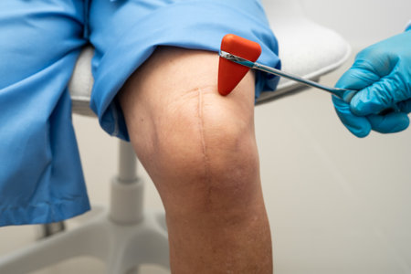 Asian doctor knock on knee reflex nerve for check and treatment senior patient in hospital.の写真素材