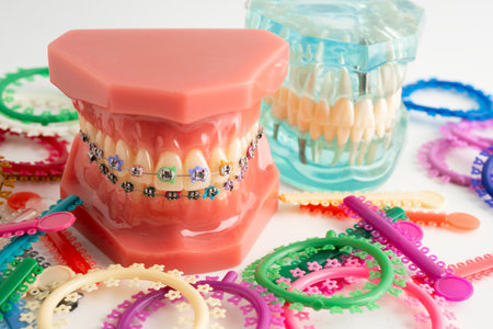 Orthodontic ligatures rings and ties, elastic rubber bands on orthodontic braces, model for dentist studying about dentistry.の写真素材