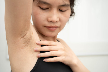 Asian woman have problem black armpit.の写真素材