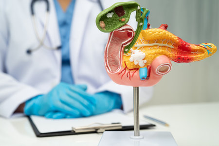 Pancreatitis, pancreatic cancer, Asian doctor with pancreas, gallbladder and bile duct human anatomy...