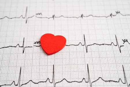 Electrocardiogram ECG heart wave, heart attack, cardiogram report.