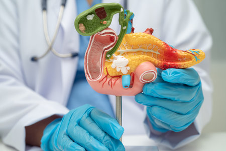 Pancreatitis, pancreatic cancer, Asian doctor with pancreas, gallbladder and bile duct human anatomy model at hospital.の写真素材