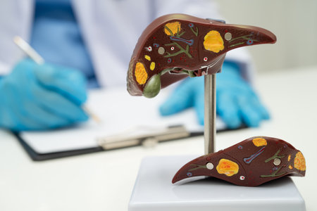 Cirrhosis, Liver cancer, fatty liver, Asian doctor with liver human anatomy model in World Hepatitis Day at hospital.の写真素材