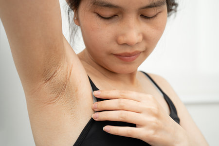 Asian woman have problem black armpit beauty skin care.の写真素材