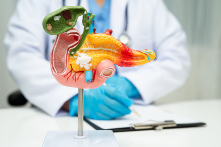 Pancreatitis, pancreatic cancer, Asian doctor with pancreas, gallbladder and bile duct human anatomy model at hospital.の写真素材