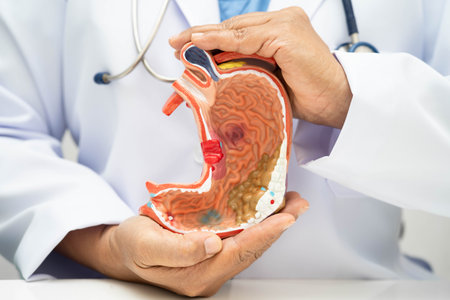 Stomach disease, doctor holding anatomy model for study diagnosis and treatment in hospital.の写真素材
