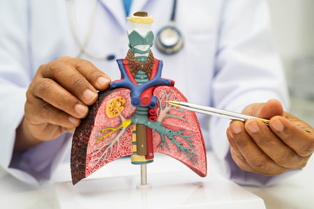 Pneumonia, lung cancer, Asian doctor holding human anatomy model for study diagnosis and treatment...