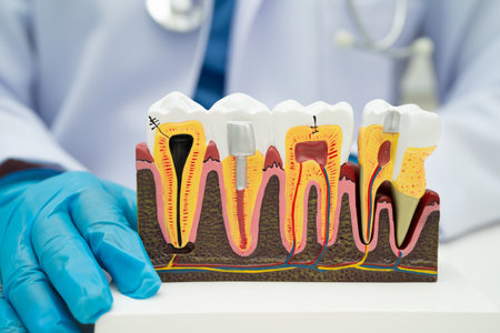 Dental implant, artificial tooth roots into jaw, root canal of dental treatment, gum disease, teeth...
