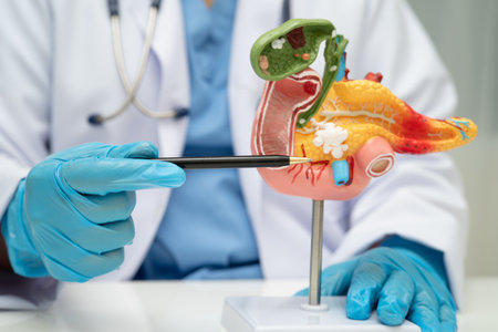 Pancreatitis, pancreatic cancer, Asian doctor with pancreas, gallbladder and bile duct human anatomy...
