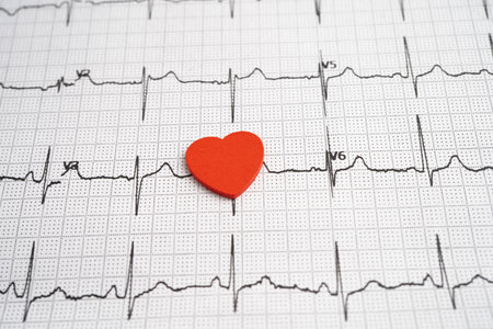 Electrocardiogram ECG heart wave, heart attack, cardiogram report.の写真素材