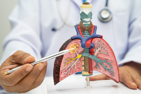 Pneumonia, lung cancer, Asian doctor holding human anatomy model for study diagnosis and treatment...