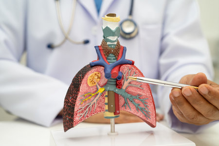 Pneumonia, lung cancer, Asian doctor holding human anatomy model for study diagnosis and treatment in hospital.の写真素材
