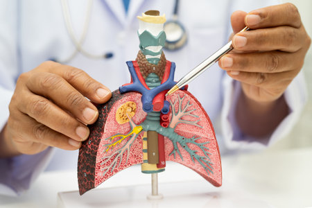 Pneumonia, lung cancer, Asian doctor holding human anatomy model for study diagnosis and treatment...