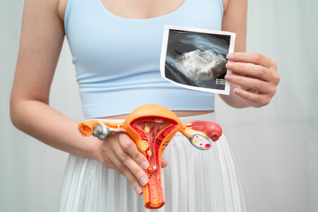 Uterus ultrasound, Asian woman holding human anatomy model.の写真素材