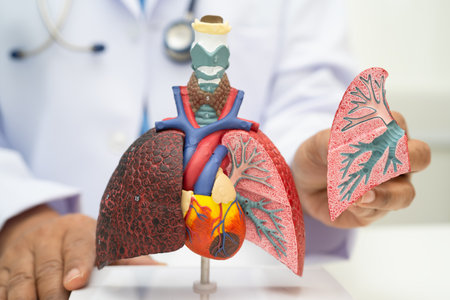 Pneumonia, lung cancer, Asian doctor holding human anatomy model for study diagnosis and treatment...