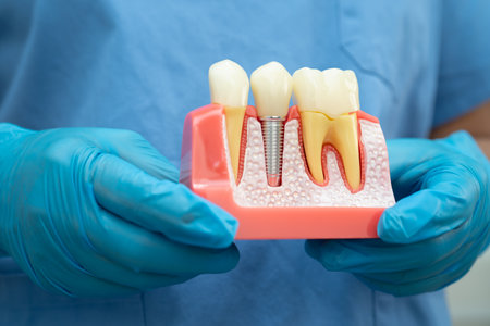 Teeth root dental model with tool for dentist use to cleaning care treatment.の写真素材