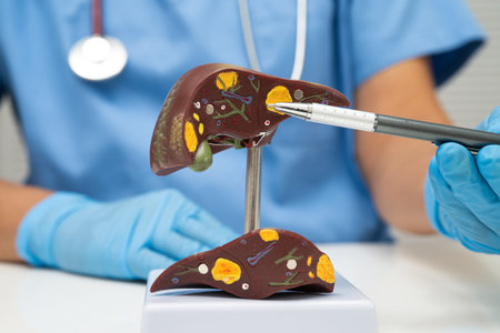Cirrhosis, Liver cancer, fatty liver, Asian doctor with liver human model.の写真素材