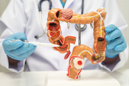 Colorectal cancer, doctor holding intestine colon human anatomy model.