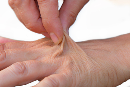 female hand of an elderly woman with loose tissue, dehydrated skinの写真素材