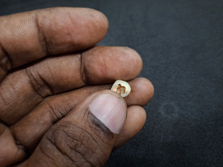 Close up of a human hand holding a tooth on a black background