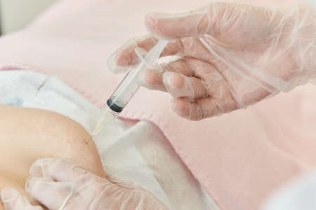 Doctor gloved hand makes an injection with plastic syringe to patient, needle is inserted under skin.の写真素材