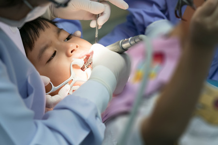 Real event photo, Cute little asian boy sitting in the dental chair and open him mouth with medical tool used to stretch the mouth during oral checkup with dentist To fill the tooth decay.の写真素材