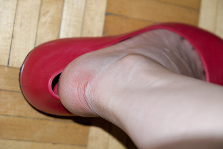 shoe pinch a footの写真素材