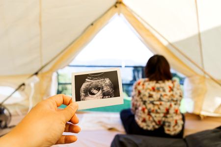 Hand holding Ultrasound imagesの写真素材