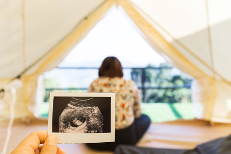 Hand holding Ultrasound imagesの写真素材