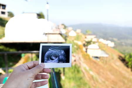 Hand holding Ultrasound imagesの写真素材