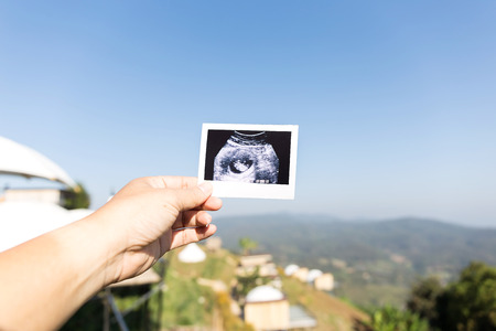 Hand holding Ultrasound imagesの写真素材