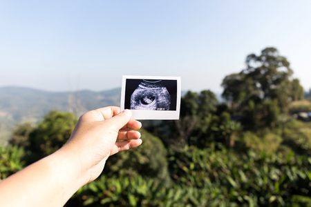 Hand holding Ultrasound imagesの写真素材