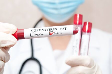 Nurse holding test tube with blood for 2019-nCoV analyzing.