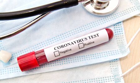 Test tube with coronavirus positive blood over laboratory desk.の写真素材