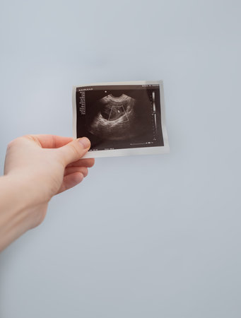 Female obstetrician-gynecologist carefully examines the ultrasound to offer the best solution for a...