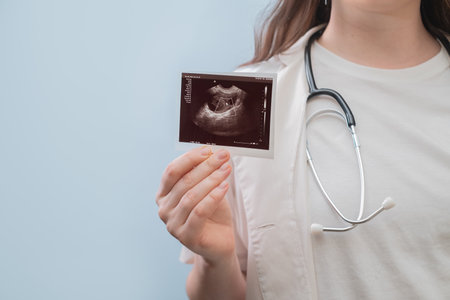 Obstetrician gently consults patient, showing ultrasound results and providing pregnancy care recommendations.の写真素材