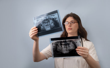 Female dentist analyzes two X-rays to detect changes and make an accurate diagnosis for the patient.
