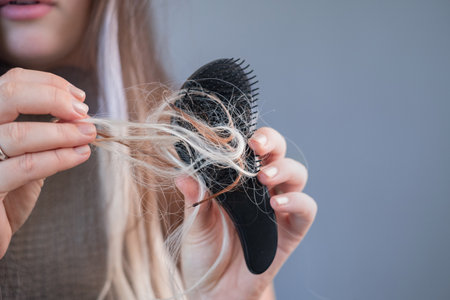 Upset young woman holding hairbrush with many fallen strands showing early signs of hair loss and breakageの写真素材