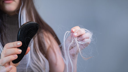 Unhappy young woman holding hairbrush with fallen strands showing hair loss breakage and early signs of alopeciaの写真素材