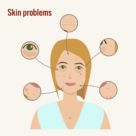 Woman's face with skin problems vector illustrationのイラスト素材