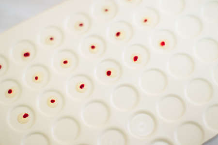 Blood test. Drops of blood on a medical tabletの写真素材