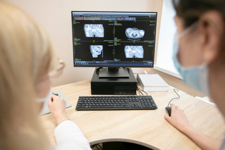 Doctors review the tomography results in a computer. Belarus, Gomel, May 30, 2021 Central Hospital.Discussion of the patient's diagnosis. Medical picture of a patient on the monitor screen.のeditorial素材