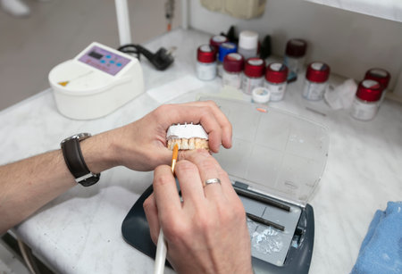 Manufacturing of dentures. Orthopedist's hands make jaw prostheses.