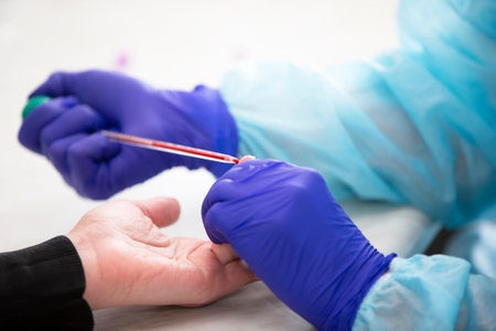 Taking blood for a general analysis, a clinical blood test. Collection of blood.の写真素材