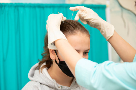 The doctor makes acupuncture on the head of a teen patient.