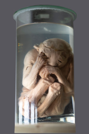 April 1, 2023. Belarus, Minsk. Exhibition of anatomical exhibits. A human infant with the pathological development of anencephaly - the absence of most of the brain, skull and scalp.のeditorial素材