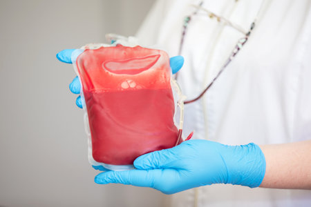 Blood plasma in the center of transfusiology and donation. close up the blood bag in the laboratory in the hands.の写真素材