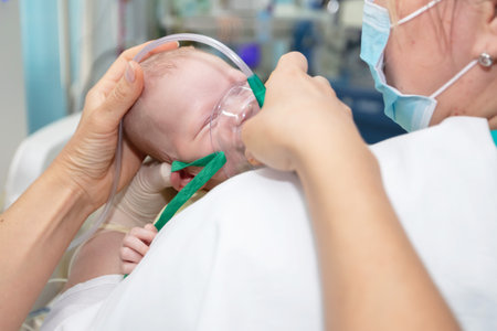 Baby with an oxygen mask in the neonatal unit.Baby wear oxygen maskの写真素材